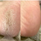 LOVASKIN PEELING INSTANTANÉ POUR LES PIEDS Spray 75 ml - 25 soins dans un flacon