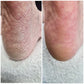 LOVASKIN PEELING INSTANTANÉ POUR LES PIEDS Flacon de Voyage - Plus de 10 soins de beauté pédicure